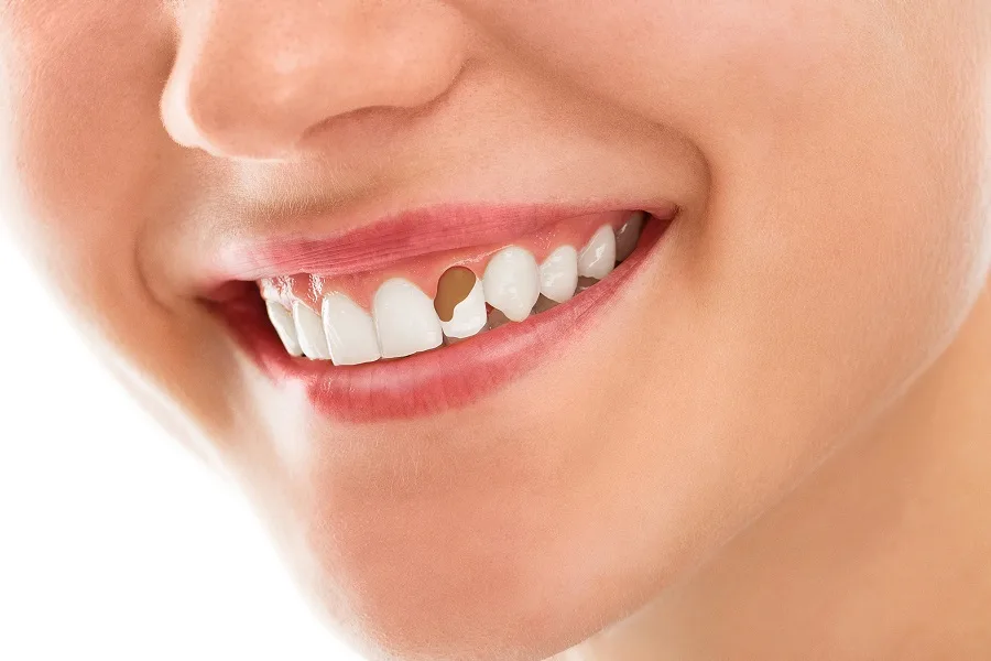 Você avisa quando tem feijão no dente?