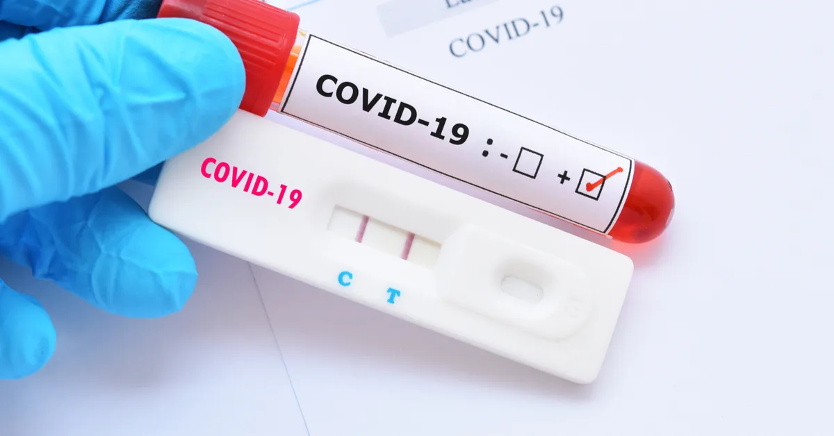 Autorização para teste de Covid-19 por planos de saúde deve ser imediata
