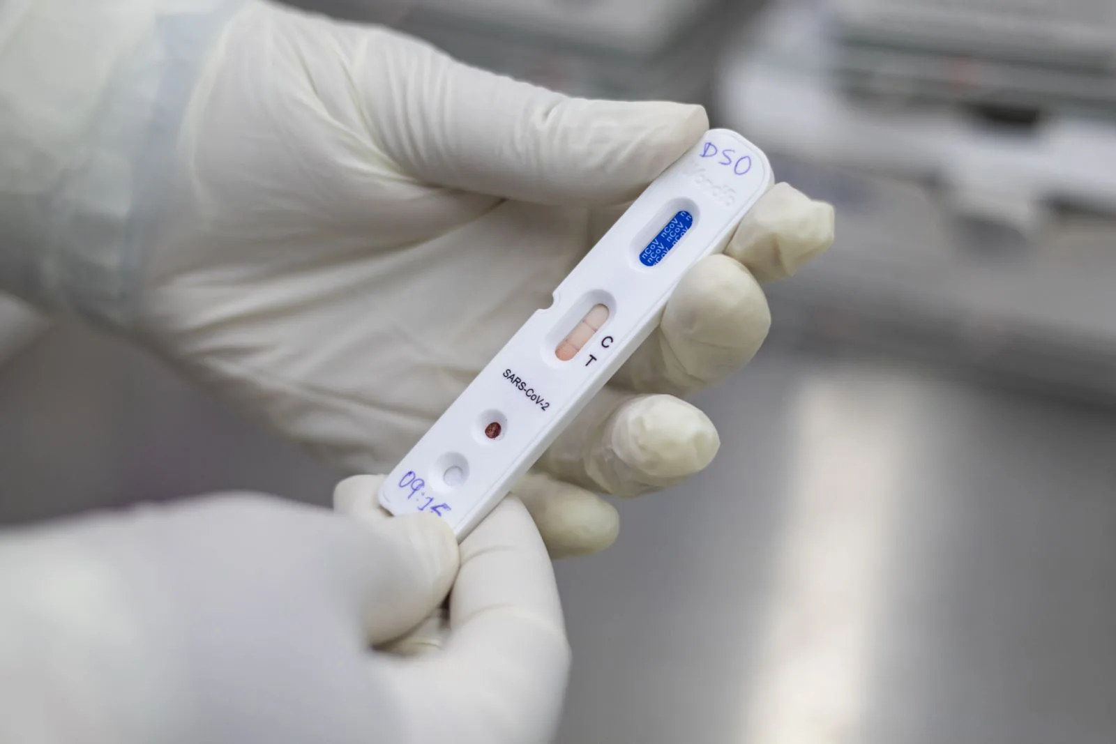 ANS decide que planos de saúde deverão cobrir obrigatoriamente testes rápidos de Covid-19