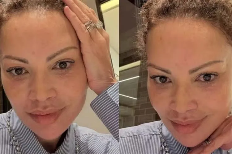 Solange Almeida causa frisson com novo rosto