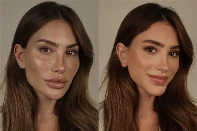 Romana Novais assusta seguidores ao simular excesso na harmonização facial e faz alerta