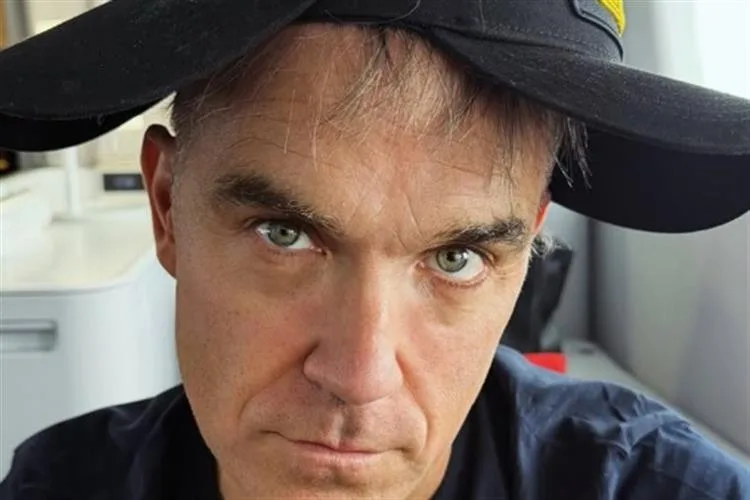 Robbie Williams desabafa sobre queda de cabelo