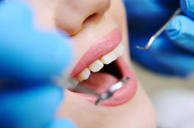 Planos odontológicos perdem 573 mil usuários na pandemia