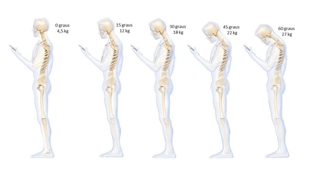 Dor cervical
