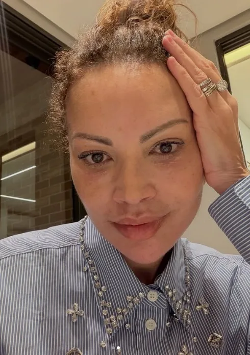 Solange Almeida causa frisson com novo rosto