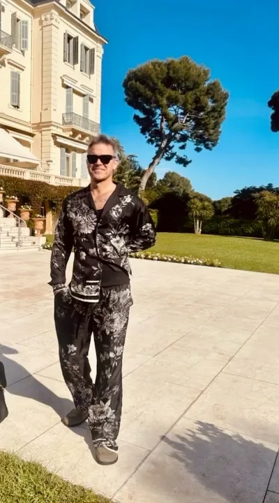 Robbie Williams desabafa sobre queda de cabelo